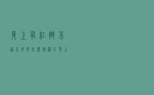 身上有红斑不痛不痒是什么病图片（身上有红斑不痛不痒是什么病）