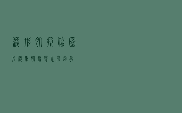 菱形肌损伤图片（菱形肌损伤怎么回事）